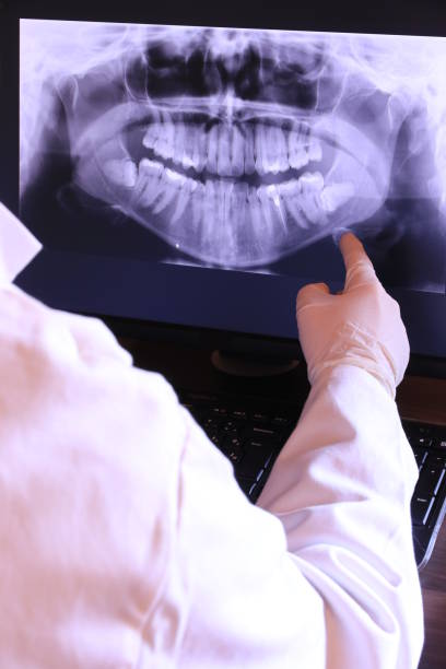 Best Emergency Wisdom Teeth Removal in Akron, OH