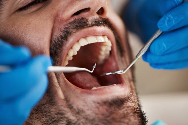 Best Emergency TMJ Treatment in Akron, OH