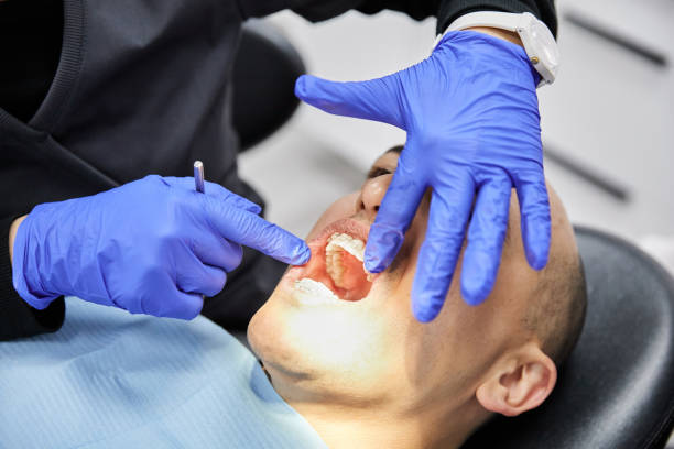 Best Urgent Care for Lost Fillings or Crowns in Akron, OH