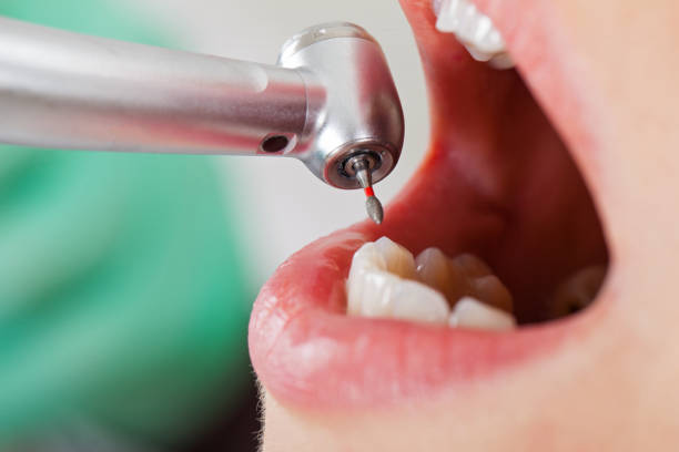 Best Cosmetic Emergency Dentistry in Akron, OH